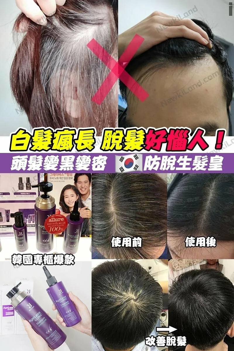 【NEW】韓國 RU:T Hair Scalp 防脫黑髮皇系列 洗髮水 370ml.